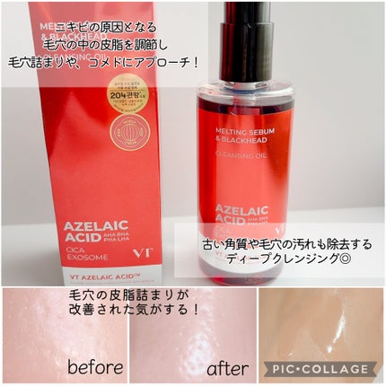 AZケア クレンジングオイル/VT/オイルクレンジングを使ったクチコミ(4枚目)