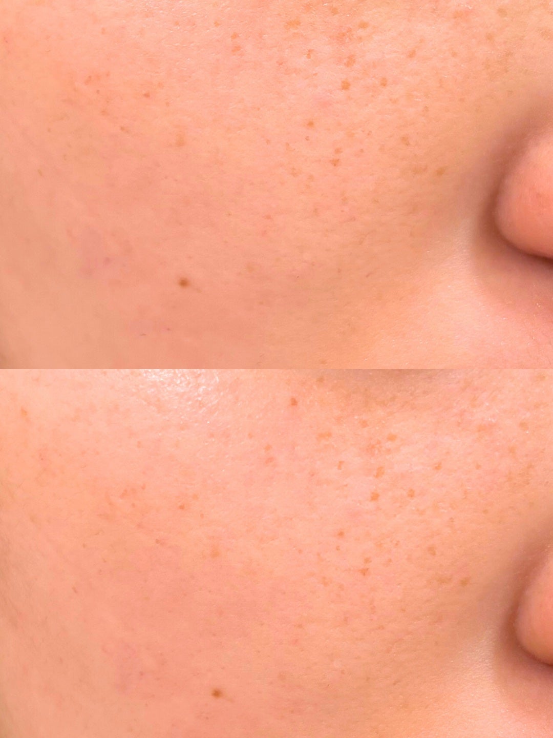 ハトムギ化粧水(ナチュリエ スキンコンディショナー R )/ナチュリエ/化粧水を使ったクチコミ(2枚目)