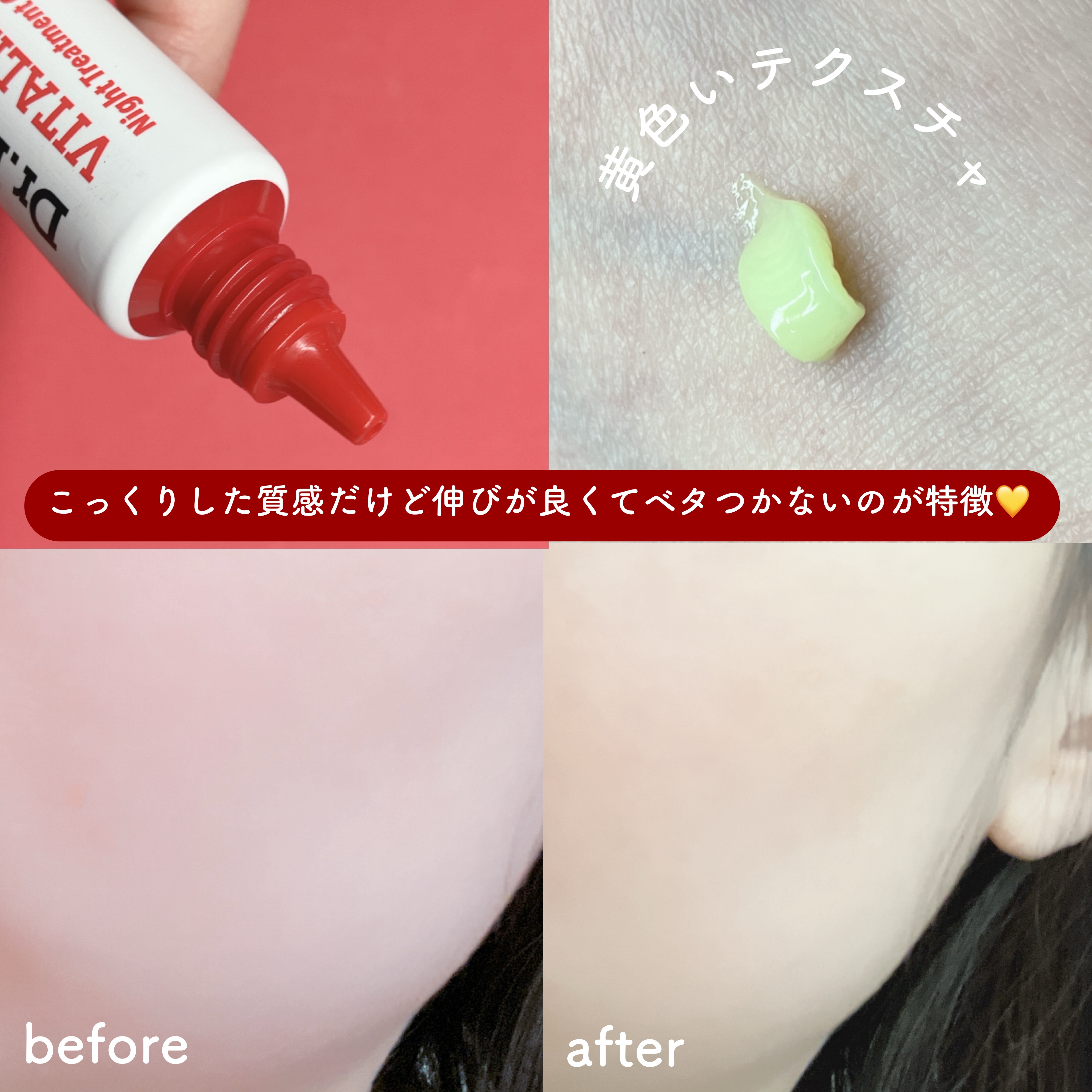 VITALIFT A forte/Dr.Different/フェイスクリームを使ったクチコミ（3枚目）