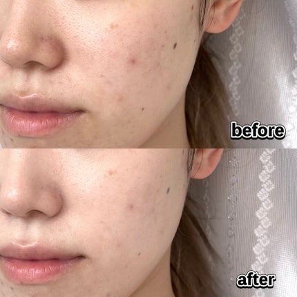 パンテノールバリアクッション/COSNORI/クッションファンデーションを使ったクチコミ(6枚目)