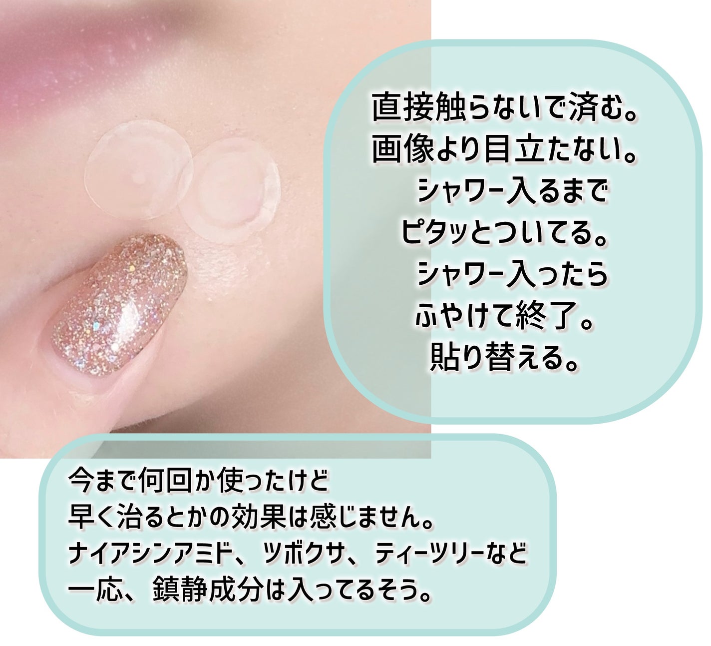 ALLDAY CLEAR PATCH/P.CALM/にきびパッチを使ったクチコミ(5枚目)