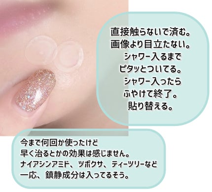 ALLDAY CLEAR PATCH/P.CALM/にきびパッチを使ったクチコミ(5枚目)