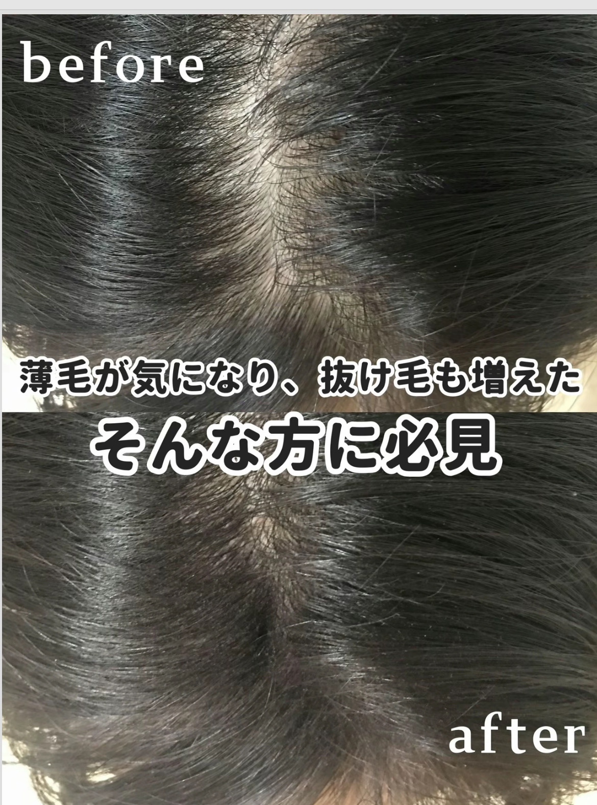 黒ツヤソフト/和漢SINCA/美容サプリメントを使ったクチコミ（2枚目）