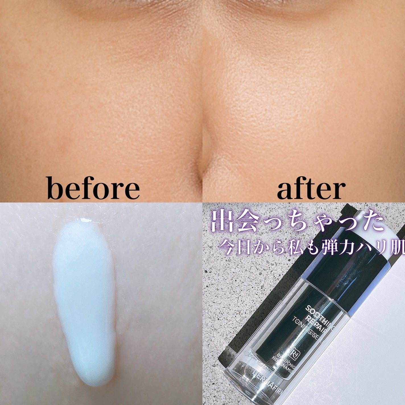 らすここ@フォロバ100 on LIPS 「ダーマファーム(DERMAFIRM)トーニングセラムR4🌸新宿..」(2枚目)