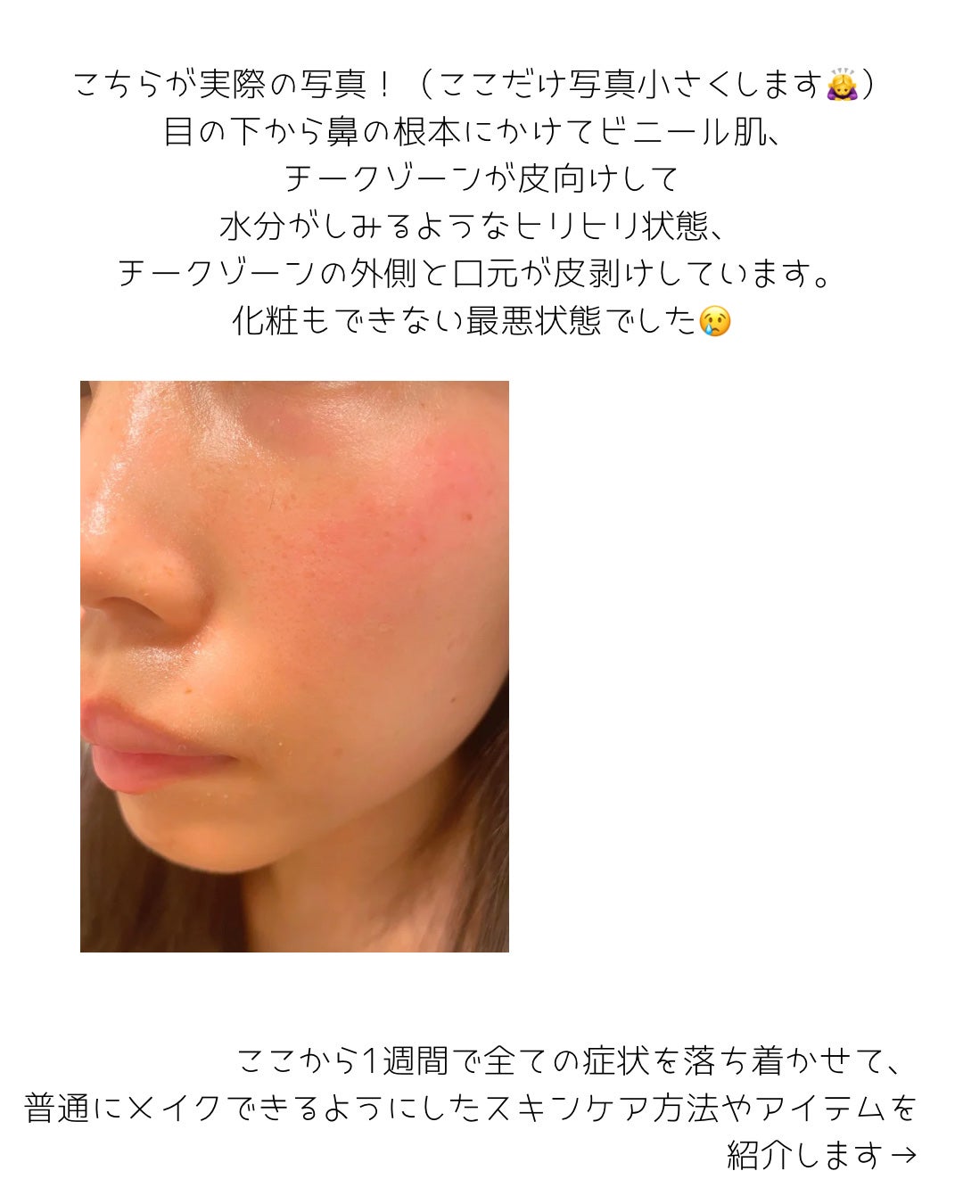 UVマイルドジェルN/マミー/日焼け止めジェルを使ったクチコミ(3枚目)