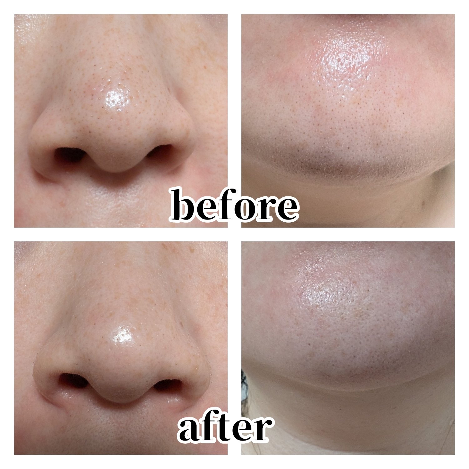 ノーモアブラックヘッド(ノーズピーリング)/One-day&#39;s you/スクラブ・ゴマージュを使ったクチコミ（3枚目）