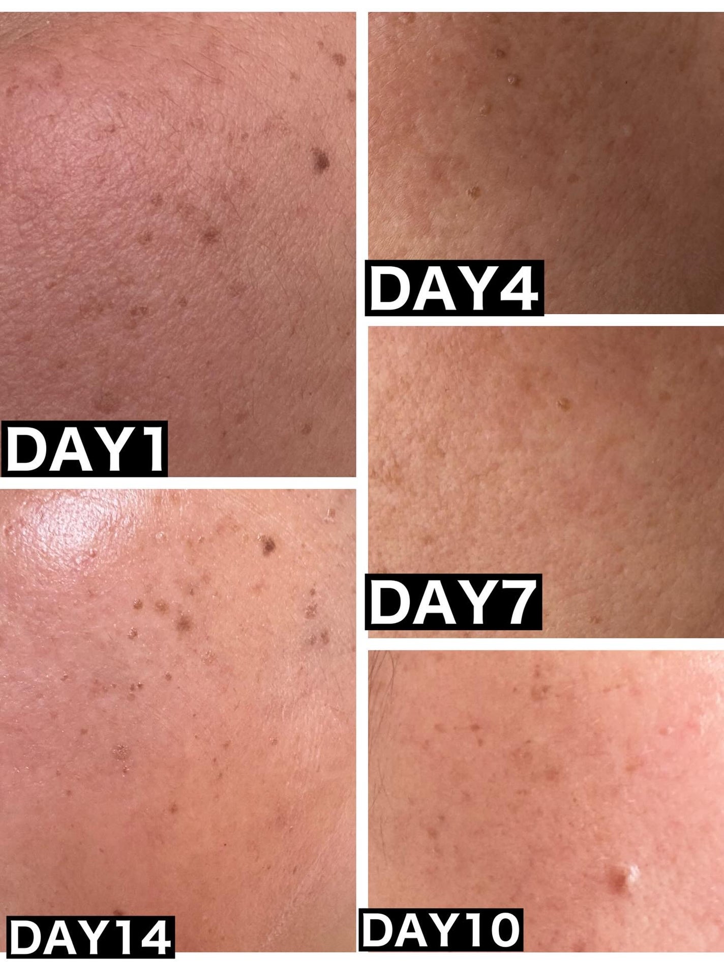 ボツルショット100/CELLINSHOT/ブースター・導入液を使ったクチコミ(7枚目)