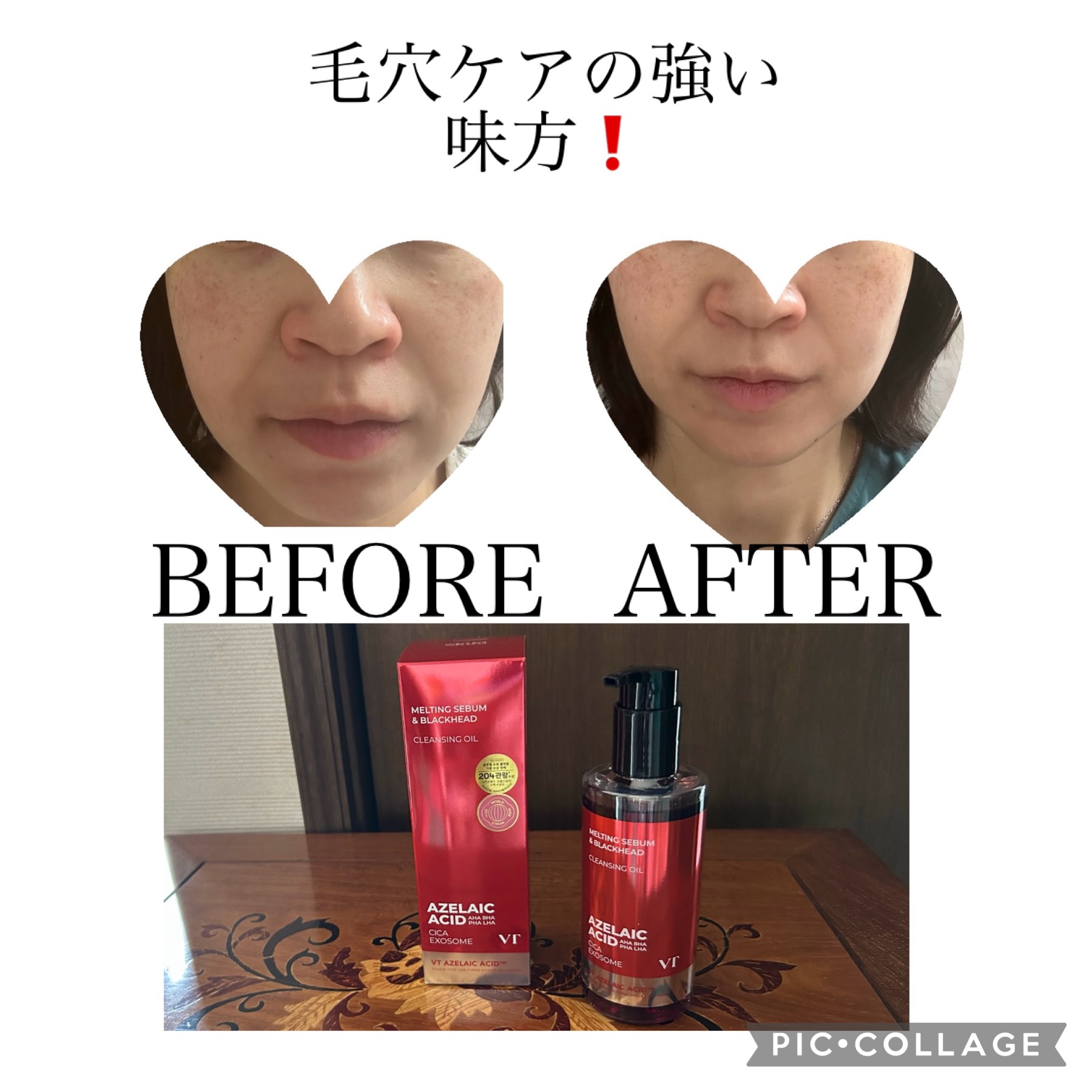 AZケア クレンジングオイル/VT/オイルクレンジングを使ったクチコミ（1枚目）