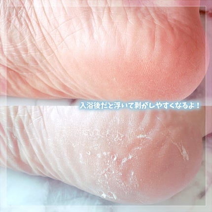 リードルショット リッチフットマスク/VT/レッグ・フットケアを使ったクチコミ(5枚目)