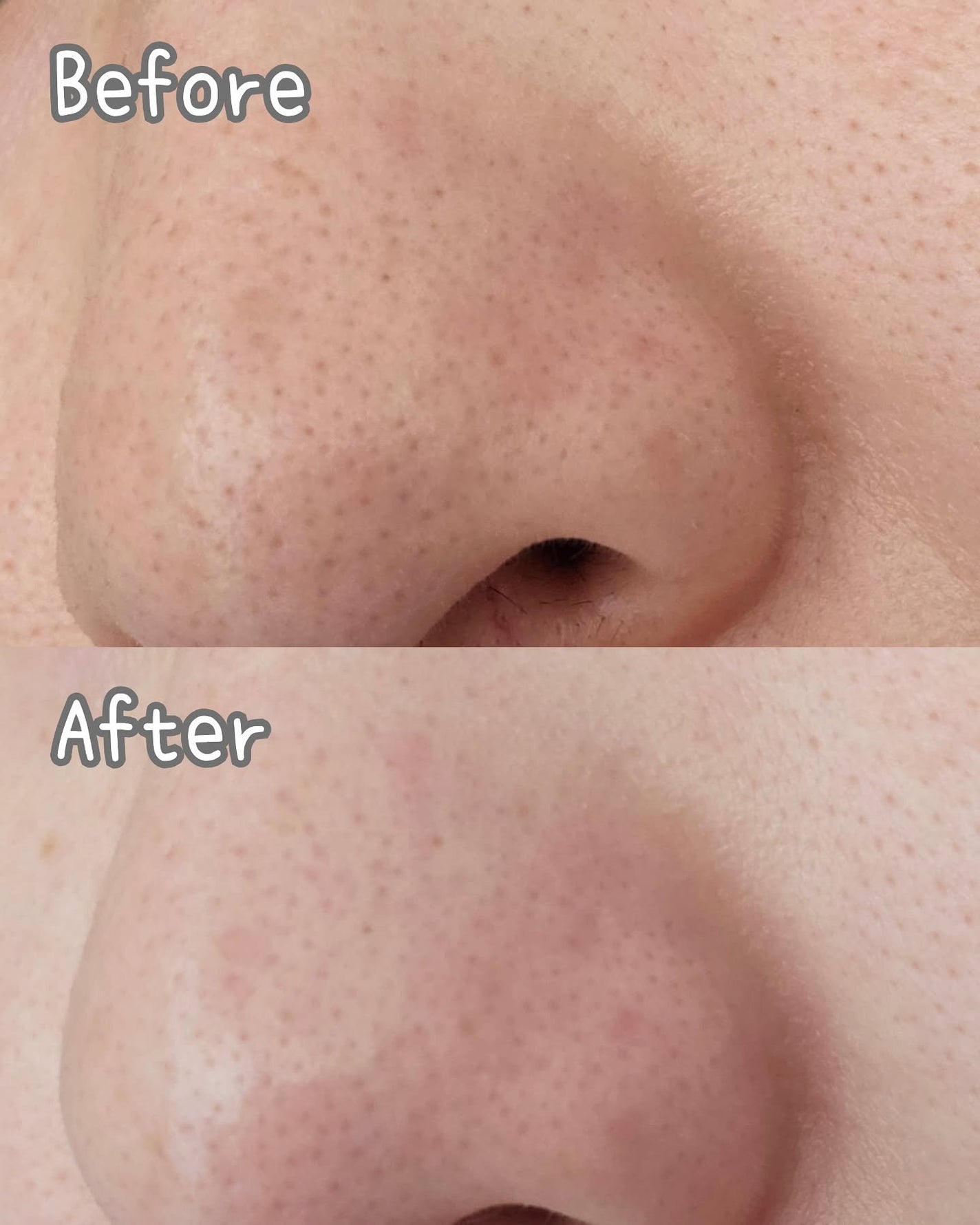 AZケア クレンジングオイル/VT/オイルクレンジングを使ったクチコミ(3枚目)