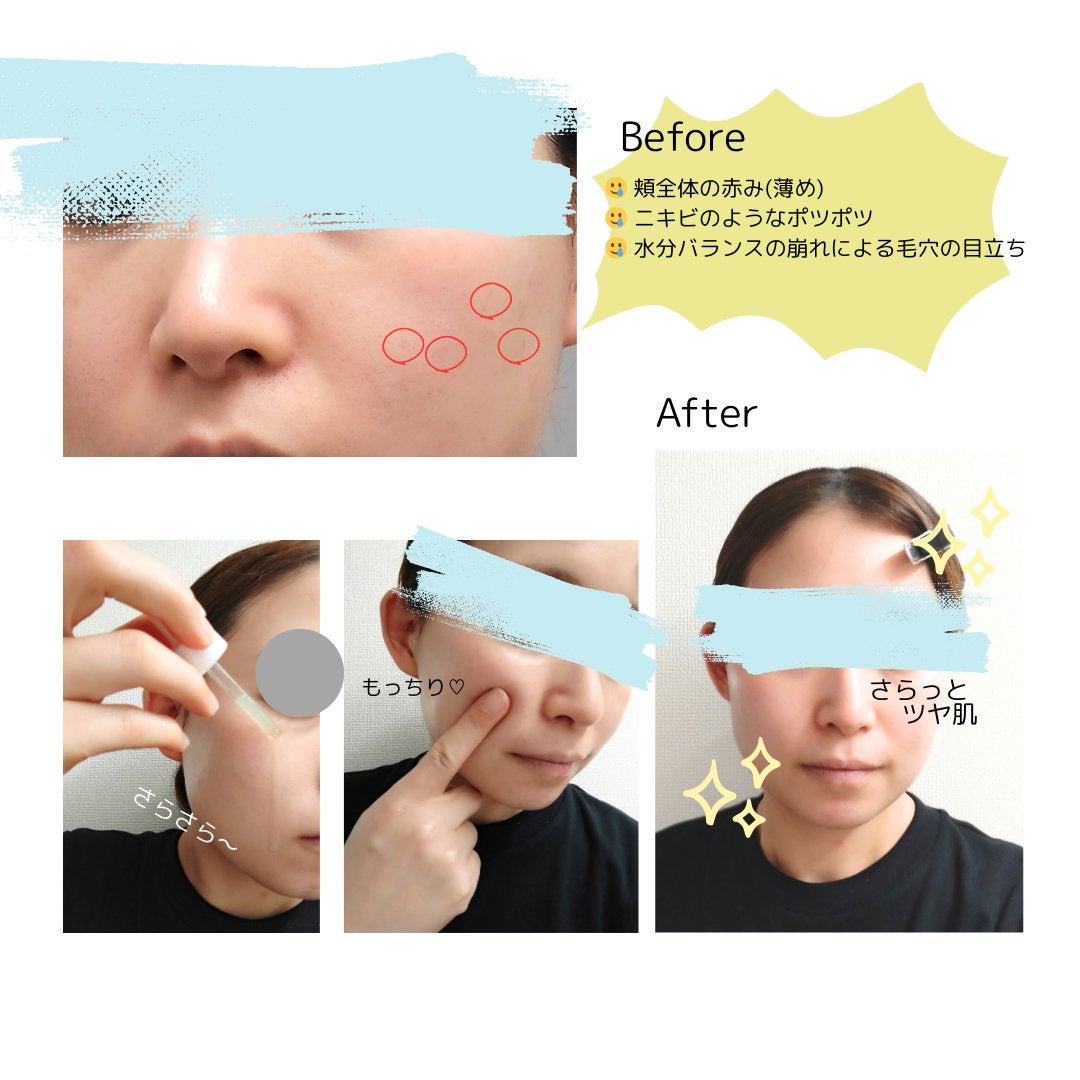 青麦ジンクセラム/Veganifect/美容液を使ったクチコミ(5枚目)