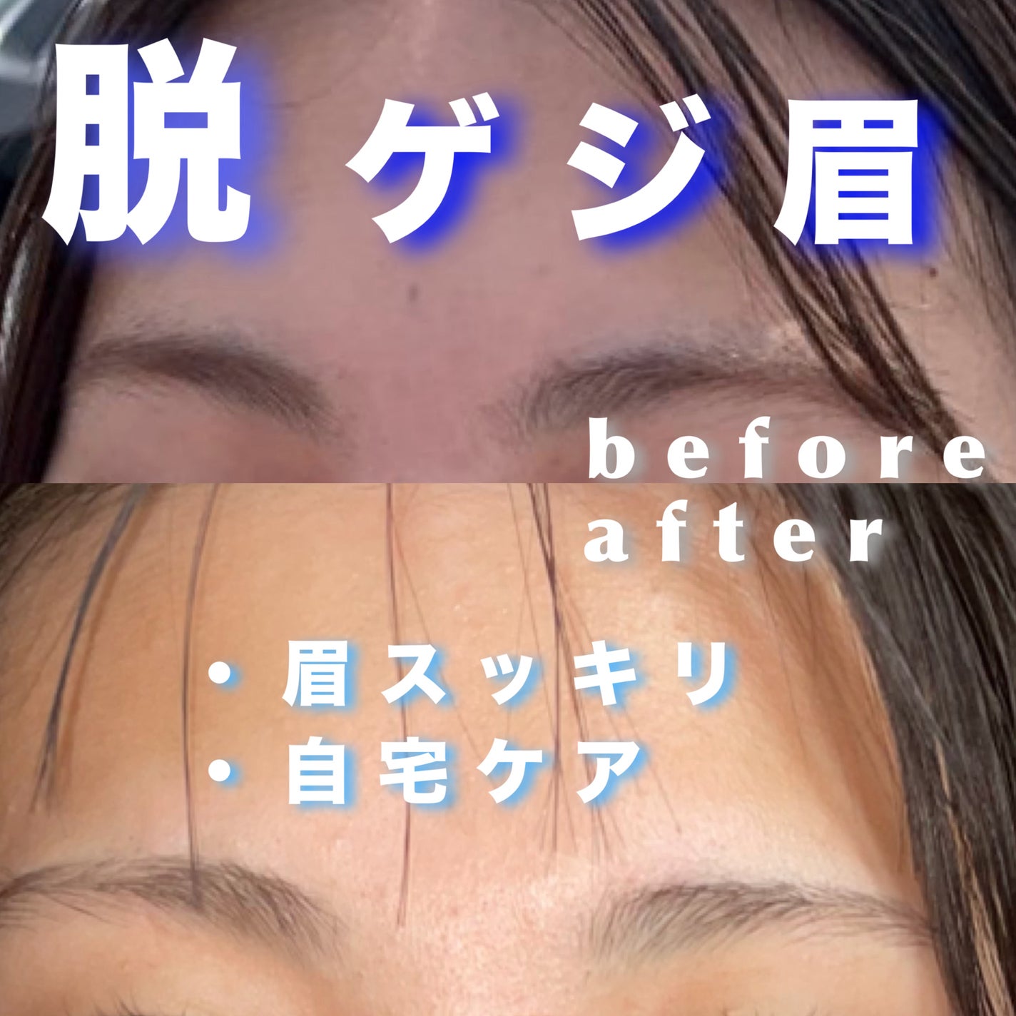 脱色クリーム 敏感肌用/エピラット/ムダ毛ケアを使ったクチコミ(1枚目)