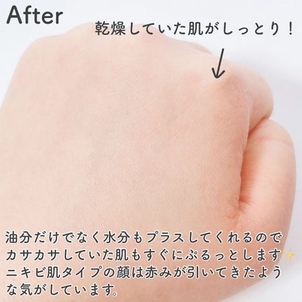 ナインクリーム/Dr.Twenty Project/フェイスクリームを使ったクチコミ(4枚目)