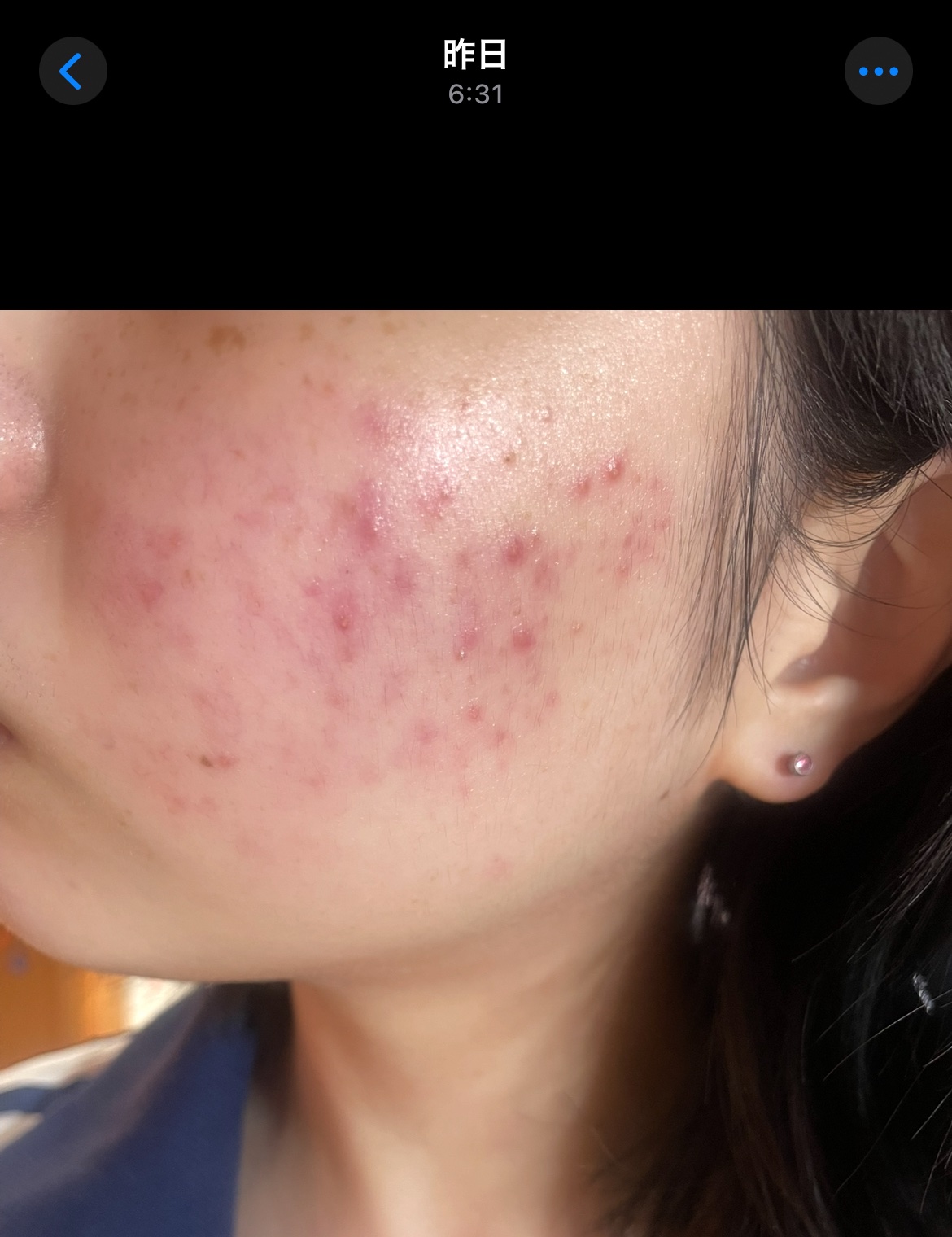 センテルリューション シカクリーム 3X/PIBUMI/フェイスクリームを使ったクチコミ（1枚目）