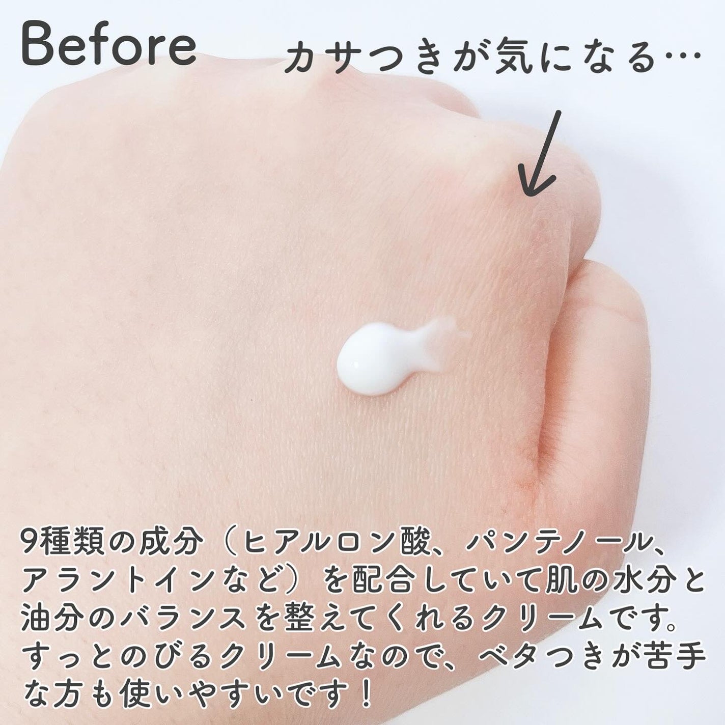 ナインクリーム/Dr.Twenty Project/フェイスクリームを使ったクチコミ(3枚目)