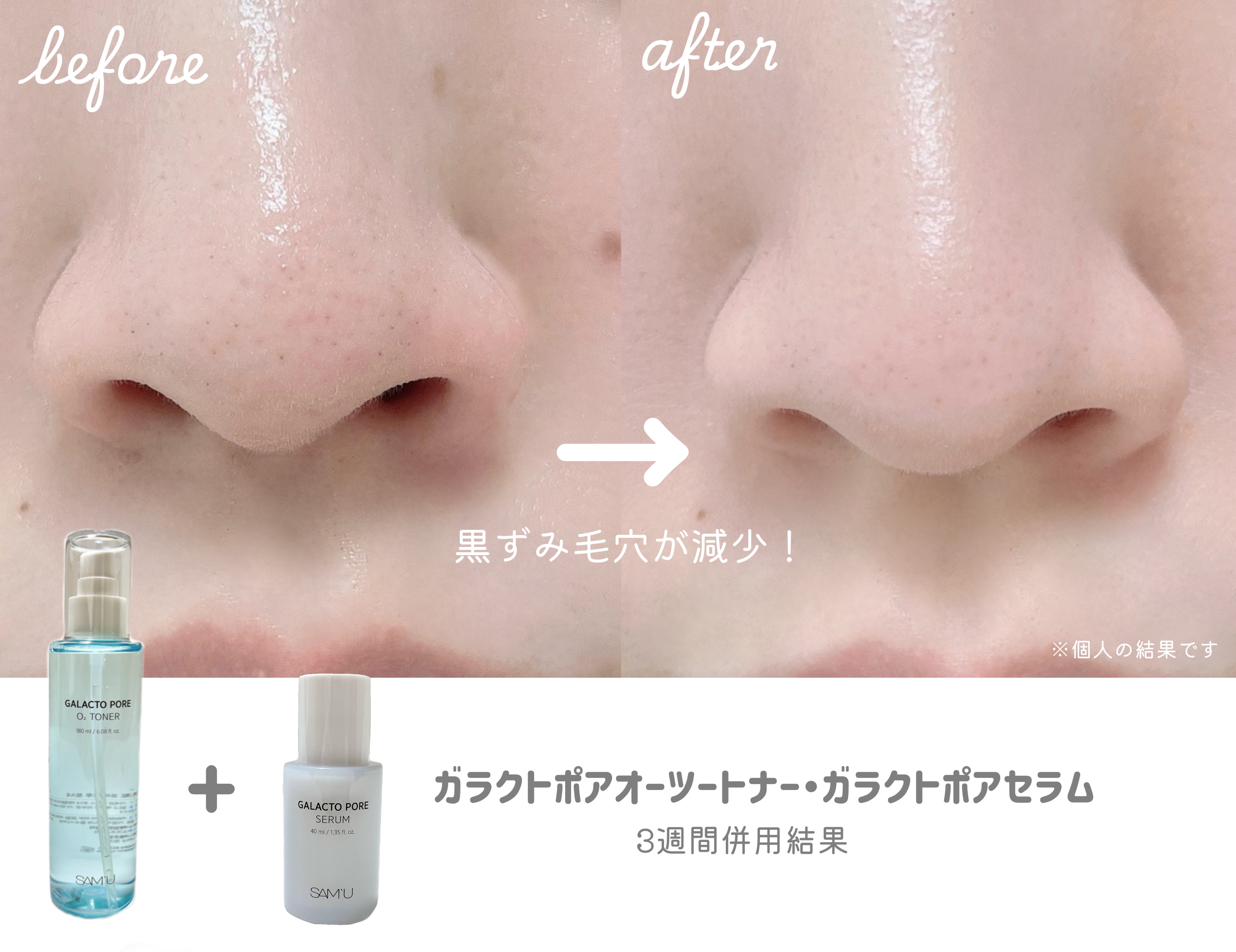 サミュ ガラクトポア セラム/SAM'U/美容液を使ったクチコミ（3枚目）