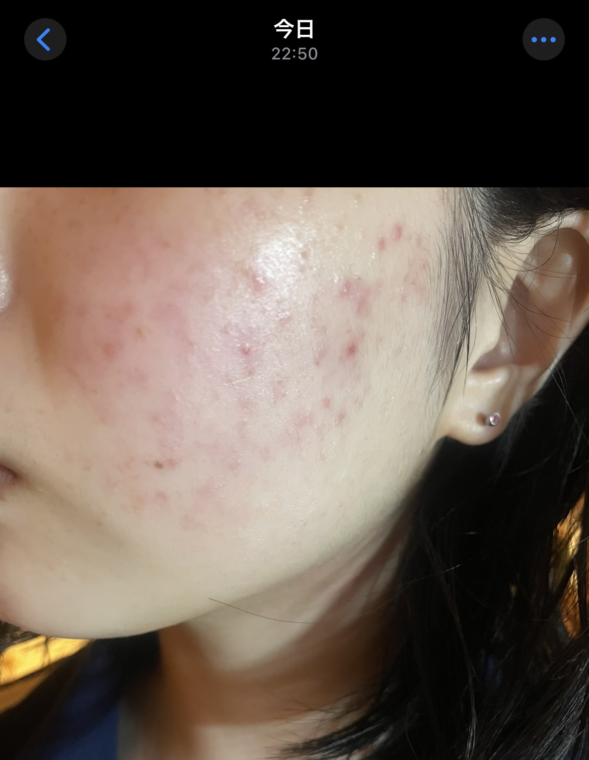 センテルリューション シカクリーム 3X/PIBUMI/フェイスクリームを使ったクチコミ（2枚目）