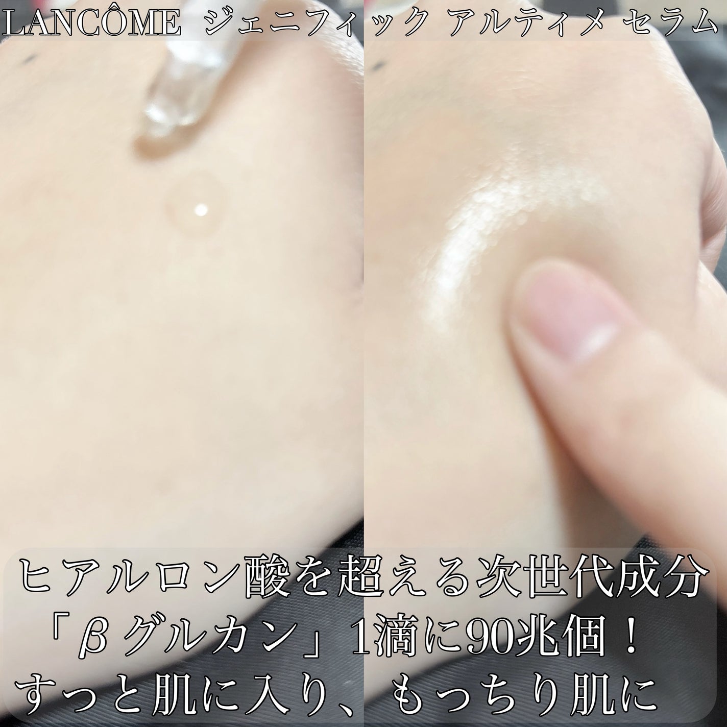 ジェニフィック アルティメ セラム/LANCOME/美容液を使ったクチコミ(2枚目)