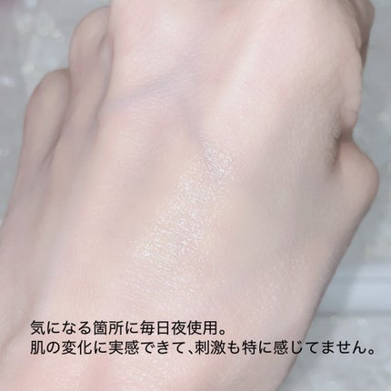 VITALIFT A forte/Dr.Different/フェイスクリームを使ったクチコミ(3枚目)