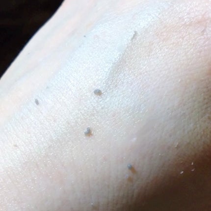 白米ピールショットゴマージュアンプル/Dr.Melaxin/美容液を使ったクチコミ(6枚目)