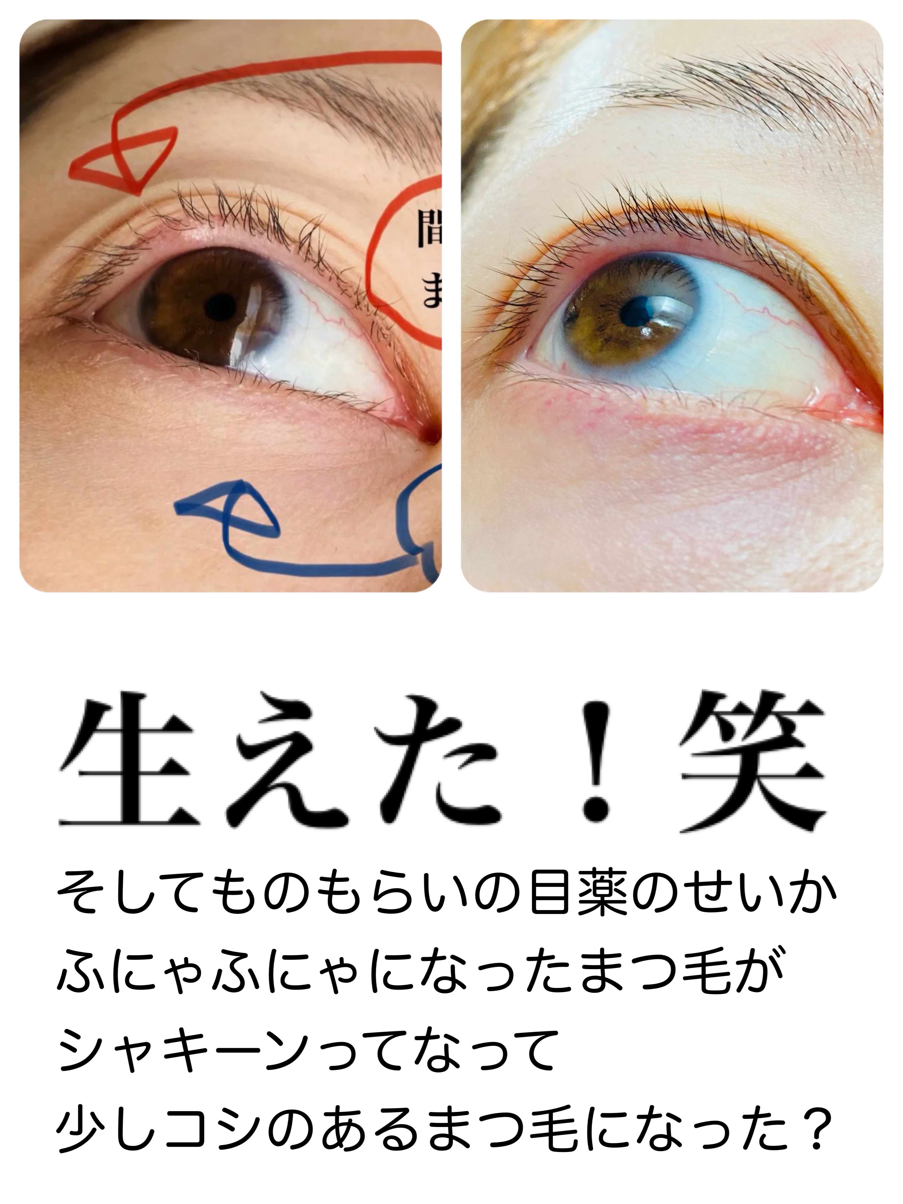 リンクルアイクリーム N/なめらか本舗/アイケア・アイクリームを使ったクチコミ（3枚目）