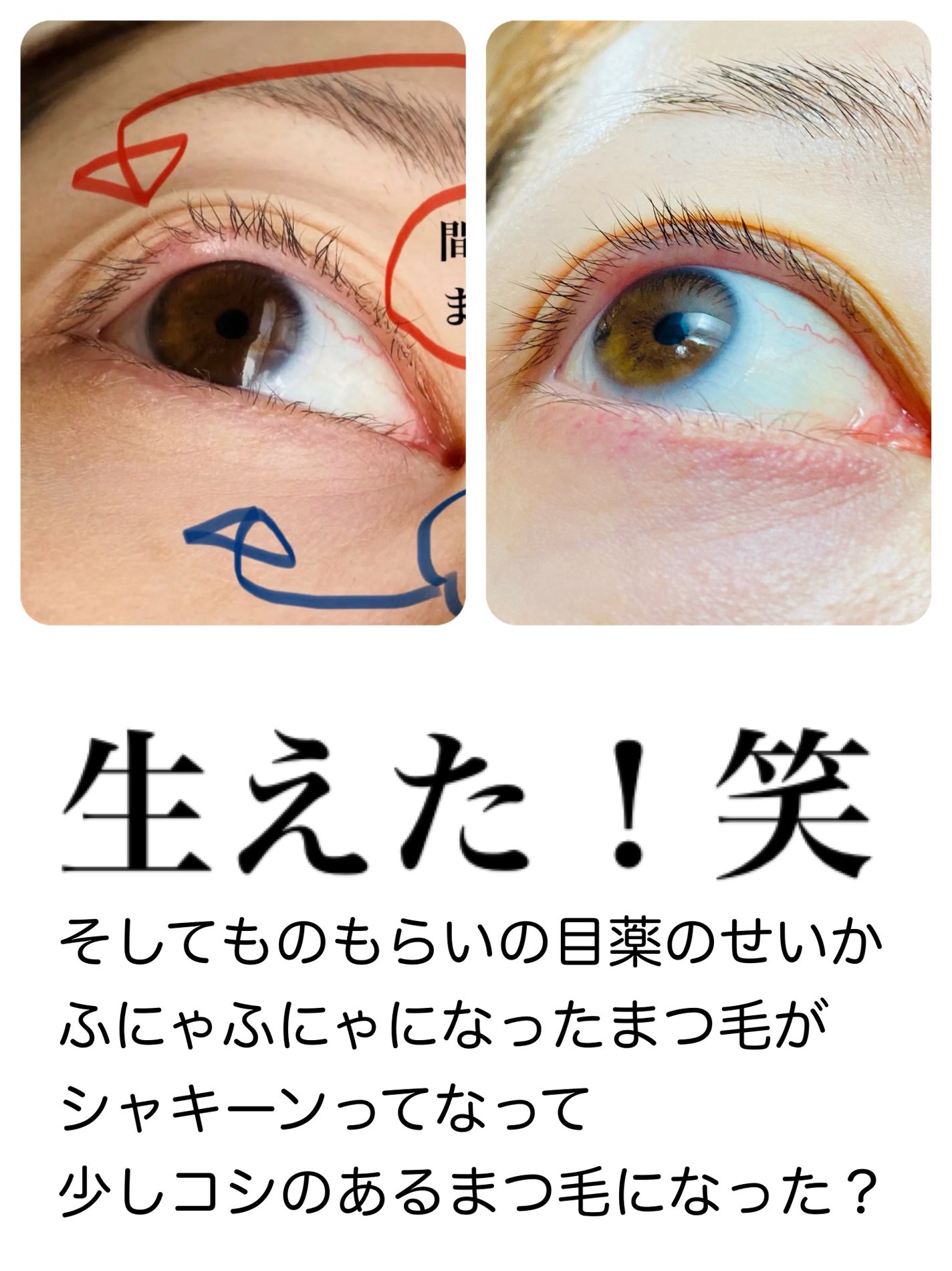 リンクルアイクリーム N/なめらか本舗/アイケア・アイクリームを使ったクチコミ(3枚目)