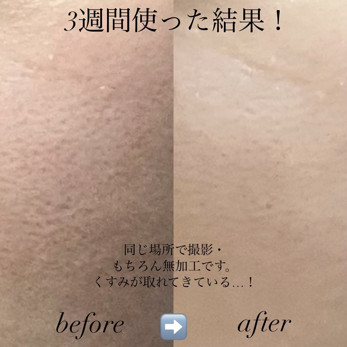 アルブチン スキンブースター セラム/MEDITHERAPY/美容液を使ったクチコミ（3枚目）