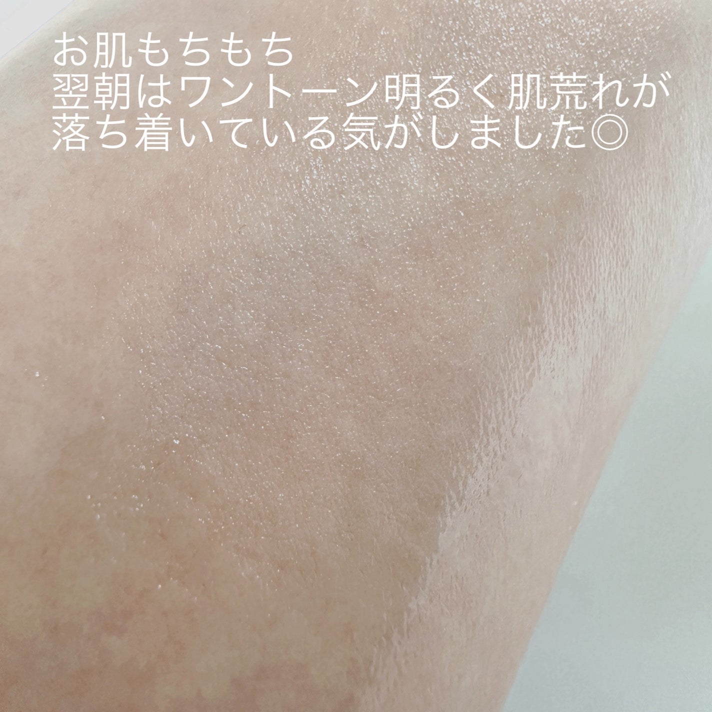 ビタ3セラム/オーズナリー/美容液を使ったクチコミ(5枚目)