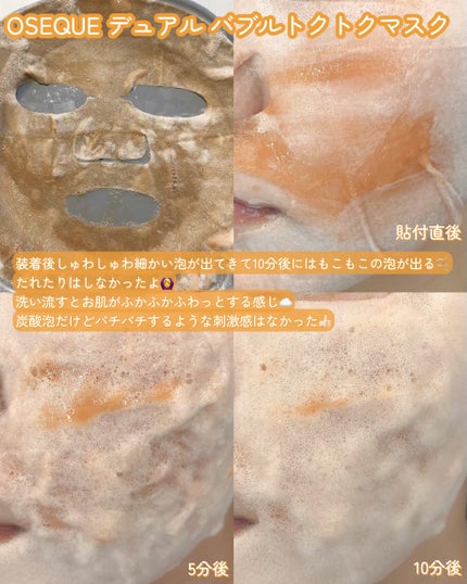 OSEQUE DUAL SKINCARE BUBBLE MASK/OSEQUE/シートマスク・パックを使ったクチコミ(3枚目)