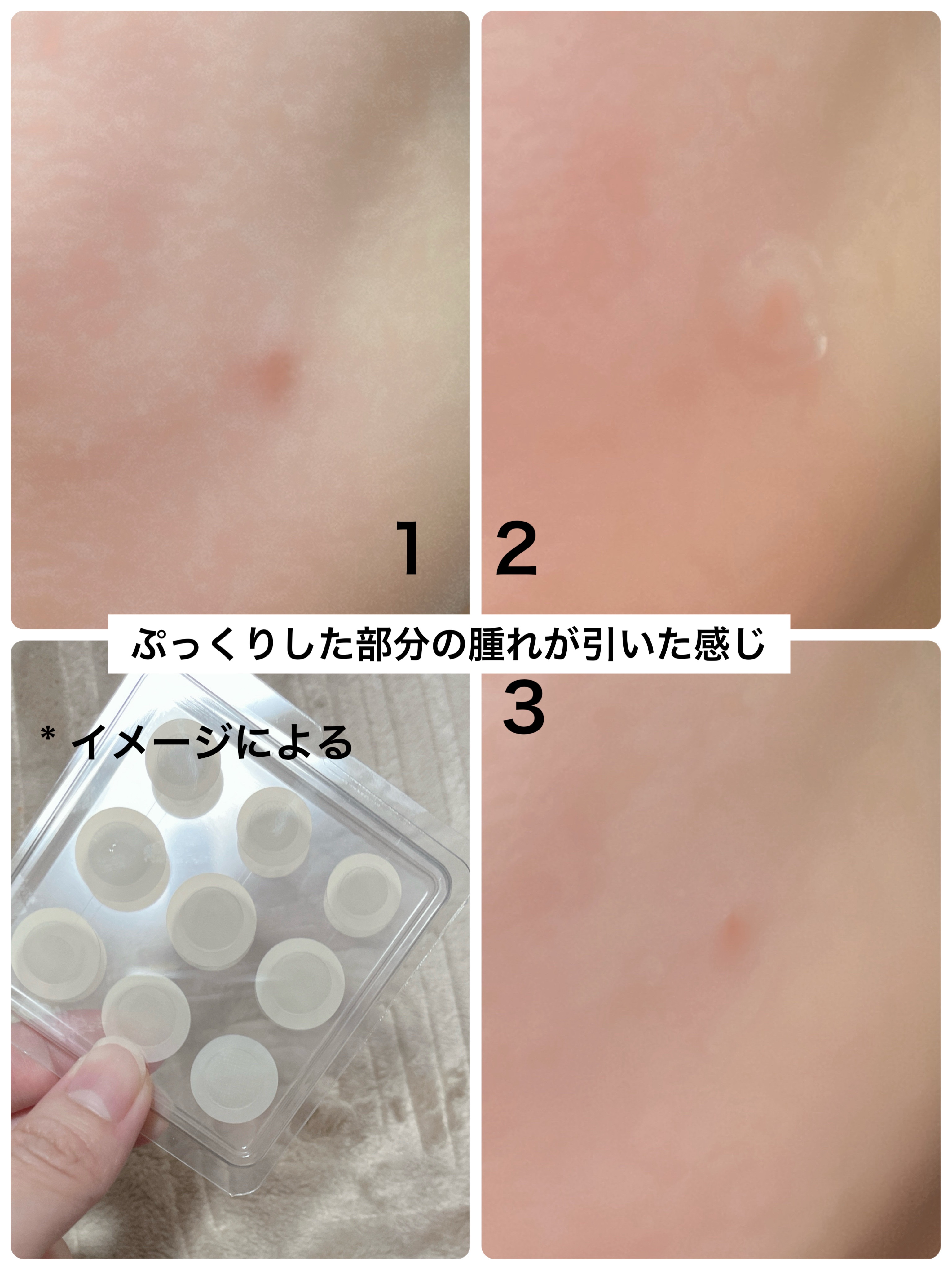 ガーリック リードルショット ポイントパッチ/VT/その他スキンケアを使ったクチコミ（3枚目）