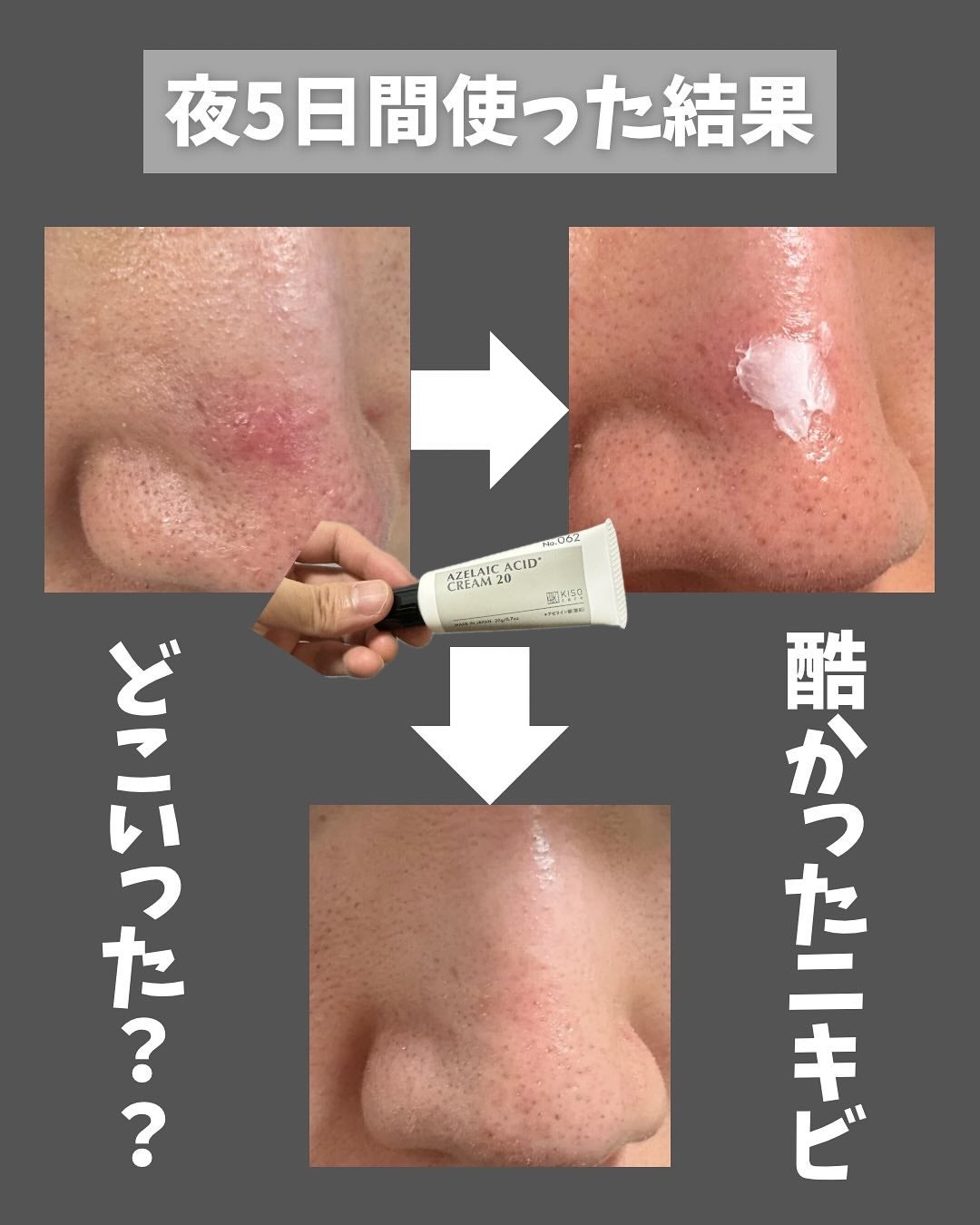 キソ バランシングクリームAZ2/KISO/フェイスクリームを使ったクチコミ(2枚目)