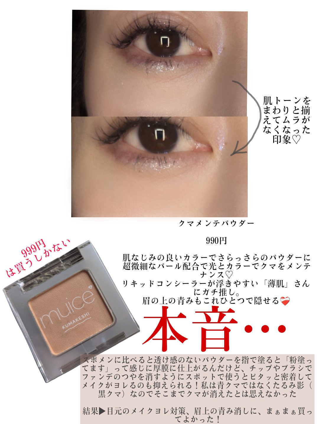 スポットメンテパウダー/muice/プレストパウダーを使ったクチコミ（2枚目）