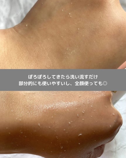 白米ピールショットゴマージュアンプル/Dr.Melaxin/美容液を使ったクチコミ(6枚目)