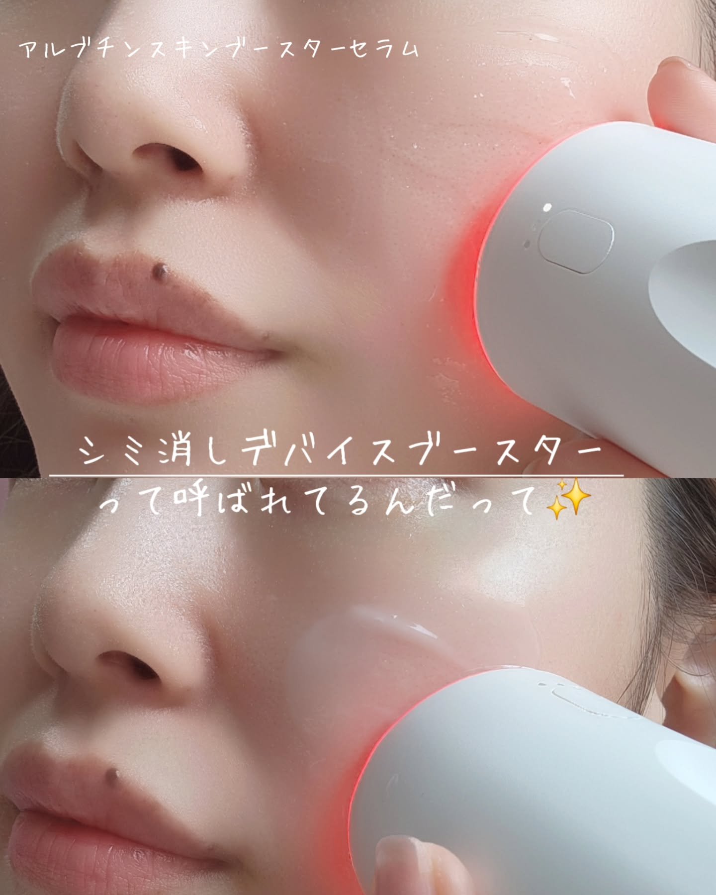 アルブチン スキンブースター セラム/MEDITHERAPY/美容液を使ったクチコミ（2枚目）