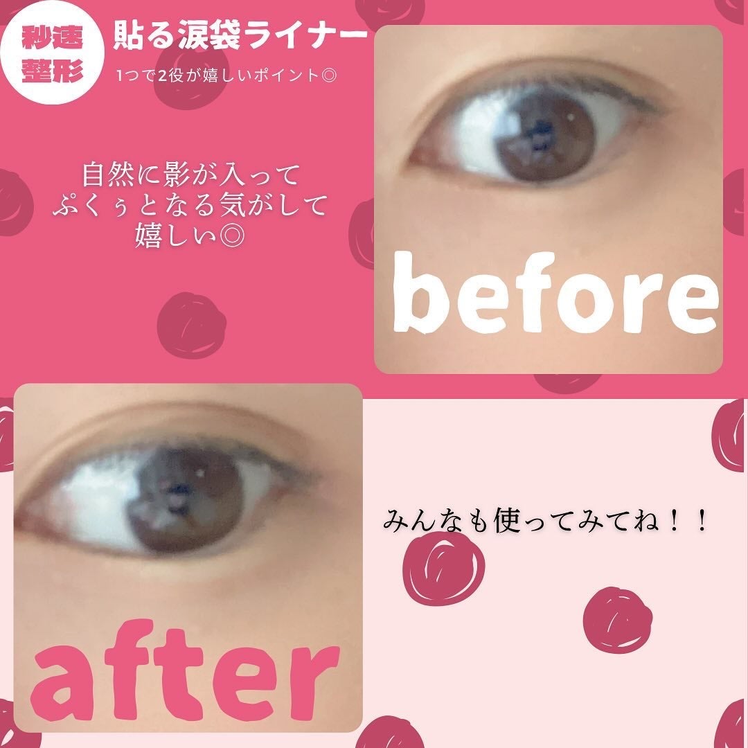 貼るだけふたえライナーテープ グレージュ/秒速整形/二重まぶた用アイテムを使ったクチコミ(7枚目)