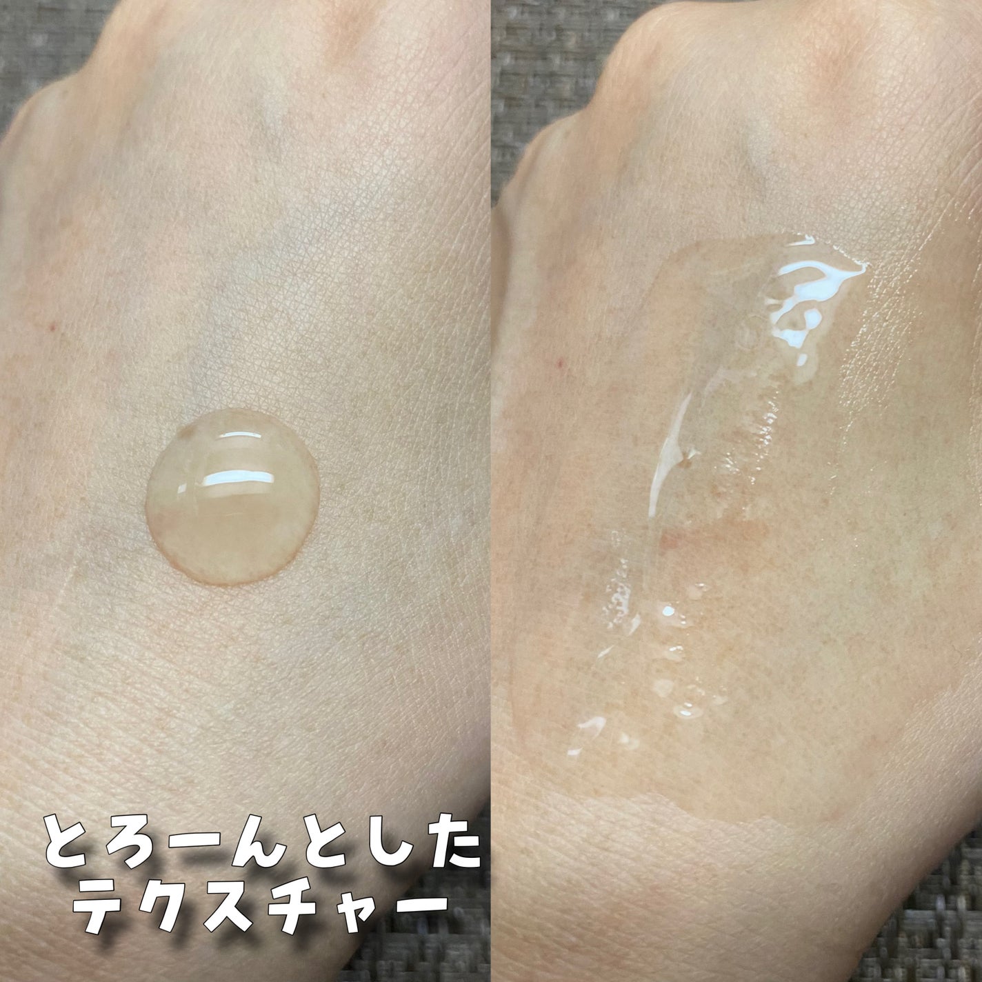 ジェニフィック アルティメ セラム/LANCOME/美容液を使ったクチコミ(5枚目)