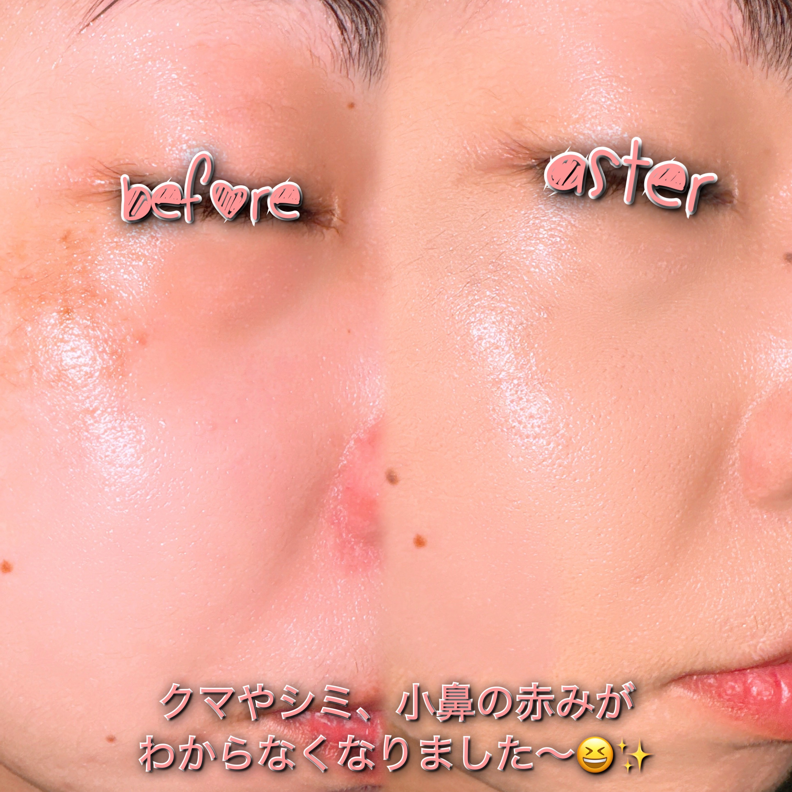 カバーアッププロコンシーラー/TFIT/パレットコンシーラーを使ったクチコミ（3枚目）