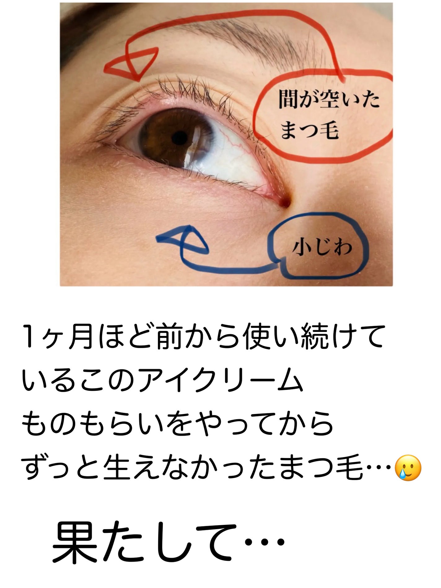 リンクルアイクリーム N/なめらか本舗/アイケア・アイクリームを使ったクチコミ(2枚目)