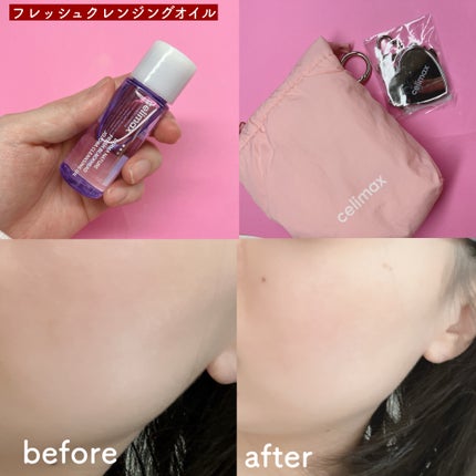 セリマックス クレンジング オイル/celimax/オイルクレンジングを使ったクチコミ(4枚目)