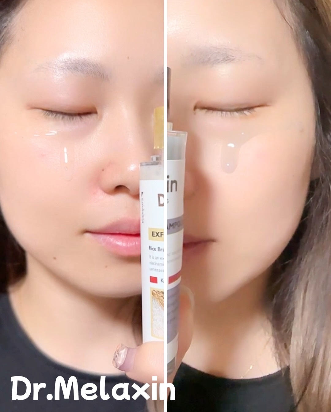 白米ピールショットゴマージュアンプル/Dr.Melaxin/美容液を使ったクチコミ（3枚目）