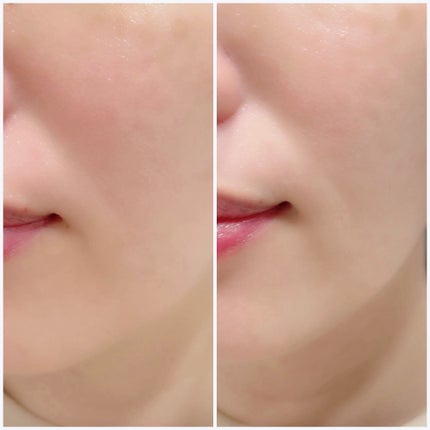 VITALIFT A forte/Dr.Different/フェイスクリームを使ったクチコミ(6枚目)