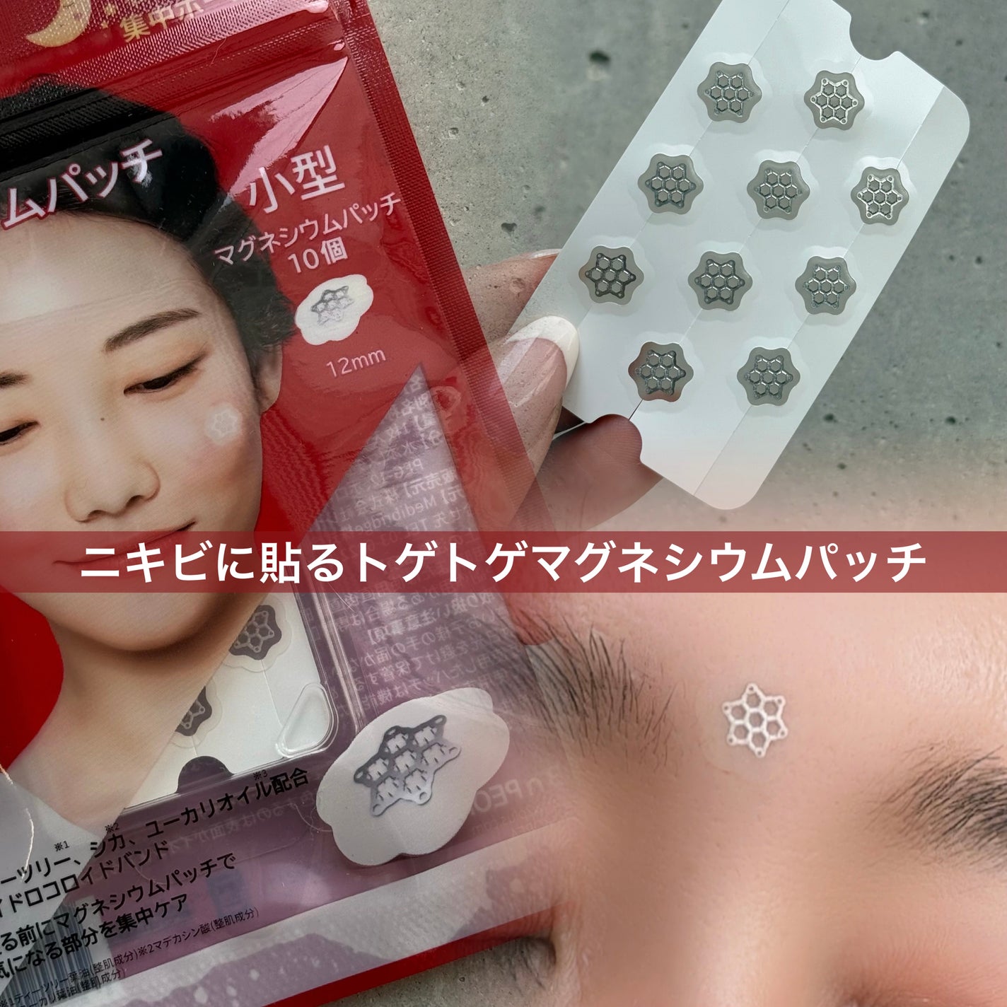 ACマグネシウムパッチ/スノーツープラス/シートマスク・パックを使ったクチコミ(1枚目)