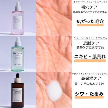 センテラ アンプル/SKIN1004/美容液を使ったクチコミ(9枚目)