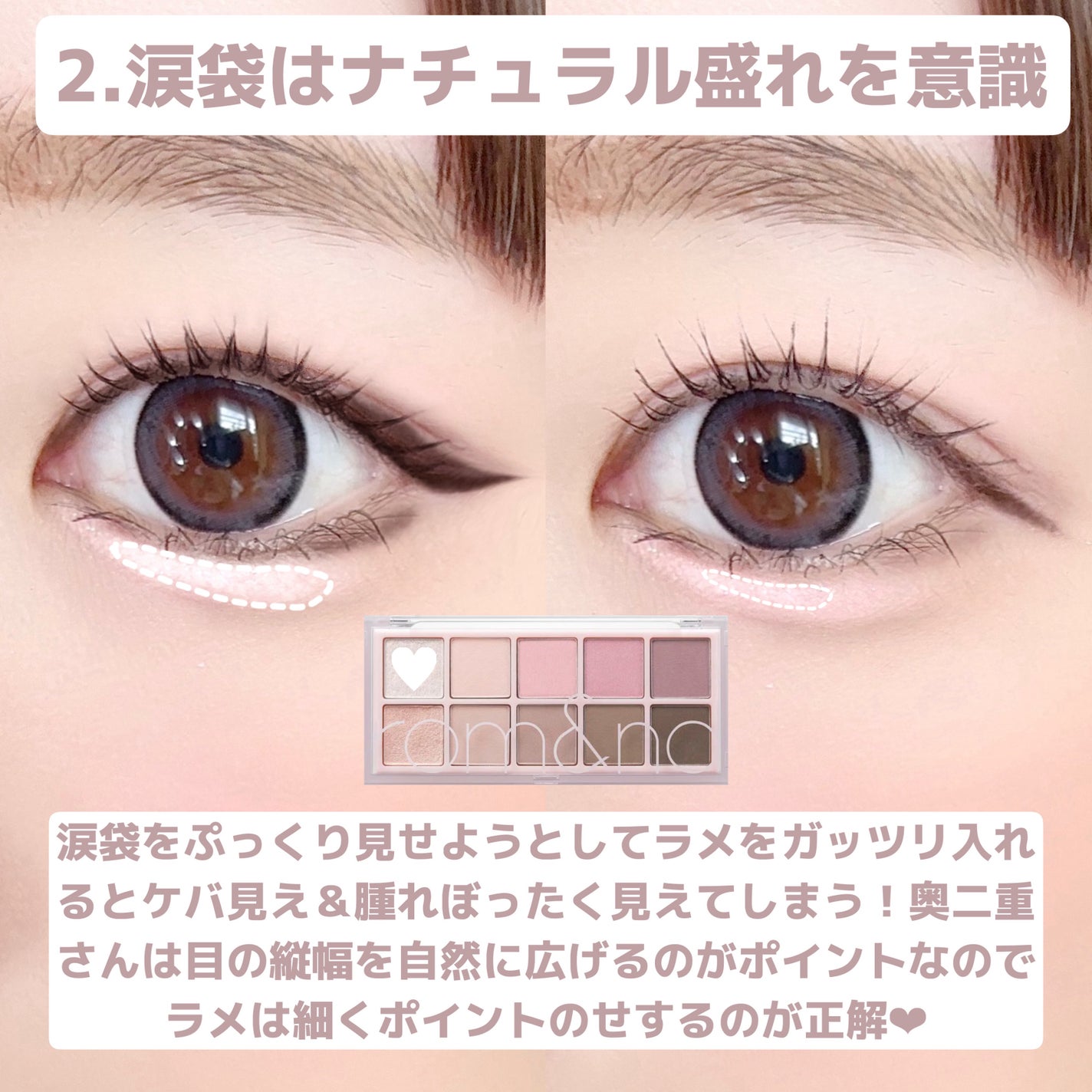 ひとえ・奥ぶたえ用カーラー/アイプチ®/ビューラーを使ったクチコミ(4枚目)