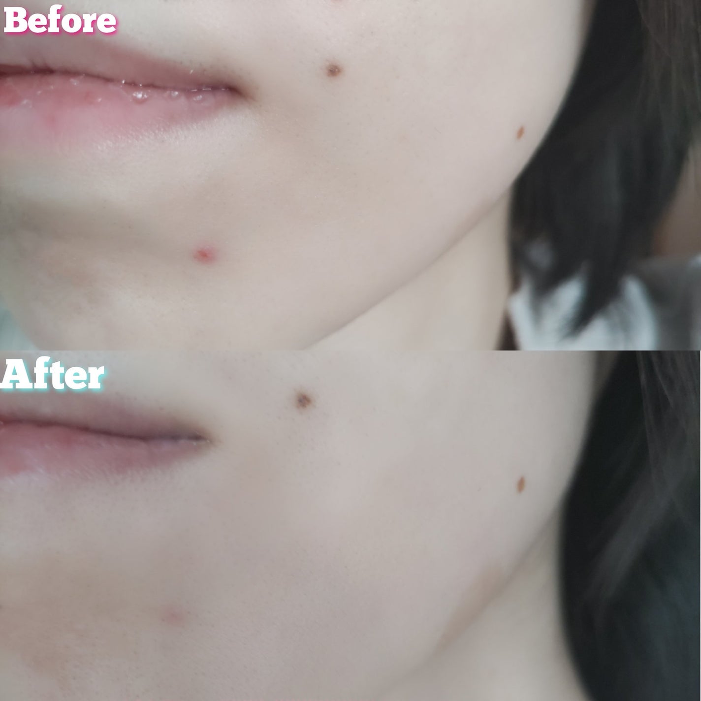 センテラスカー 軟膏 (オイントメント)/Mildlab/フェイスクリームを使ったクチコミ(7枚目)