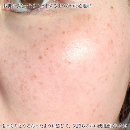 リペアジェル/リソウコーポレーション/美容液を使ったクチコミ(5枚目)