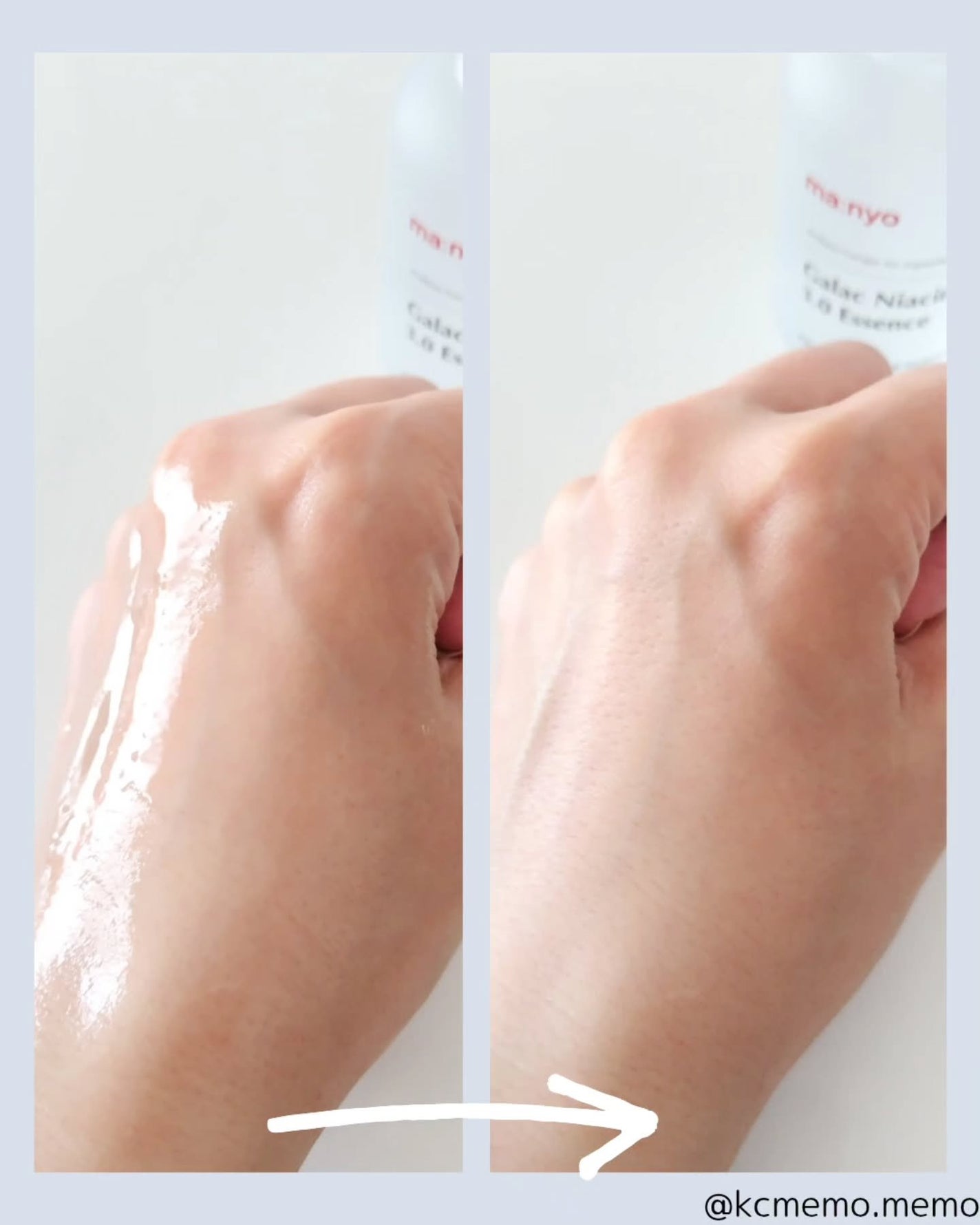 ガラク ナイアシン 3.0 エッセンス/manyo/美容液を使ったクチコミ(4枚目)