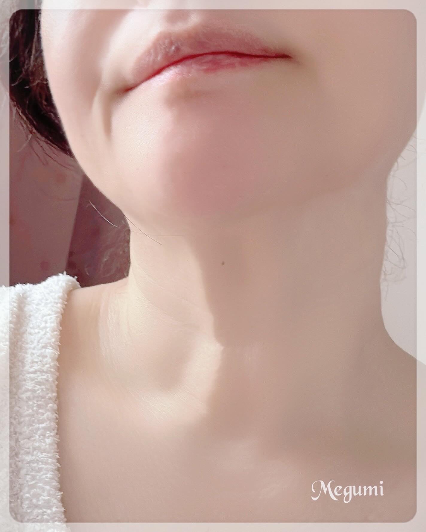 RTXペプチショットネックパッチ/Dr.G/シートマスク・パックを使ったクチコミ(6枚目)