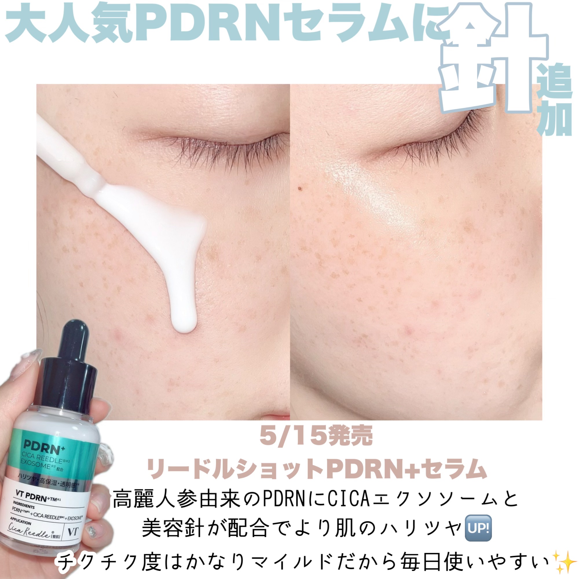 リードルS PDRN+ セラム/VT/美容液を使ったクチコミ（2枚目）