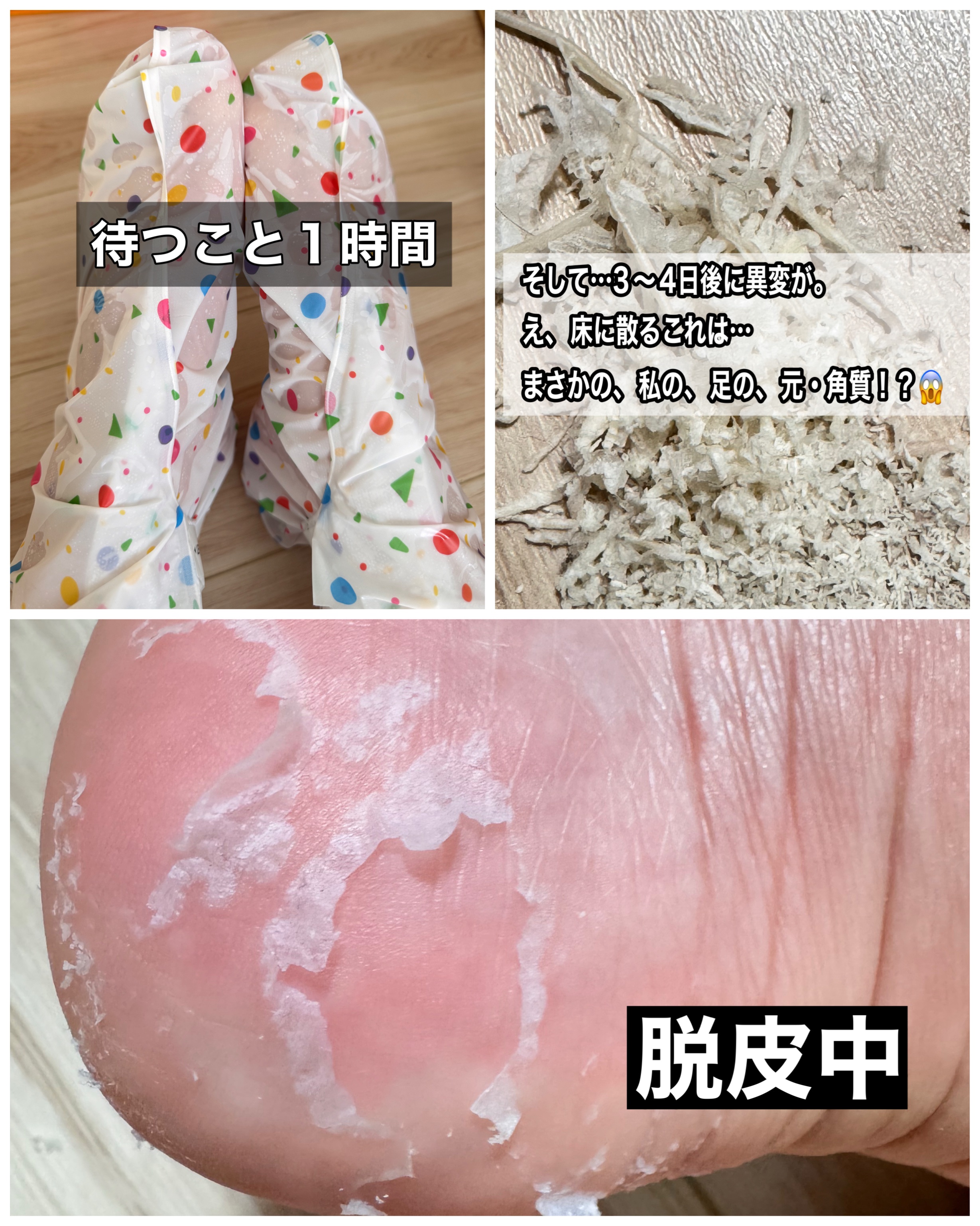 リードルショット リッチフットマスク/VT/レッグ・フットケアを使ったクチコミ（2枚目）